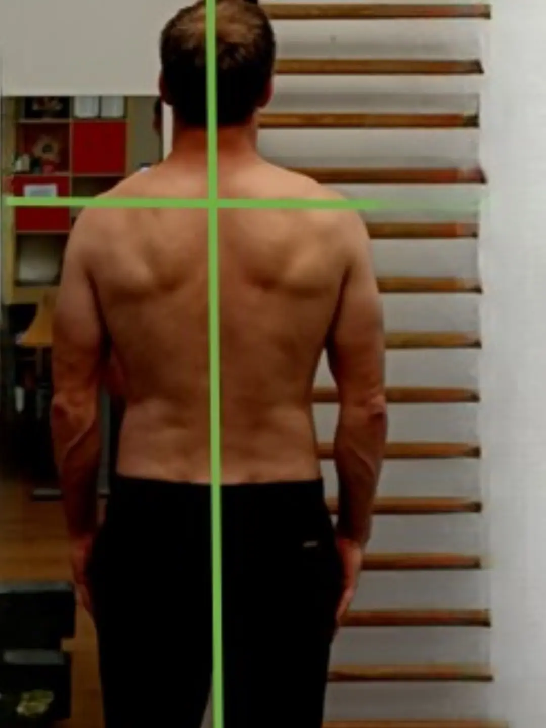 Haltungsanalyse Rücken